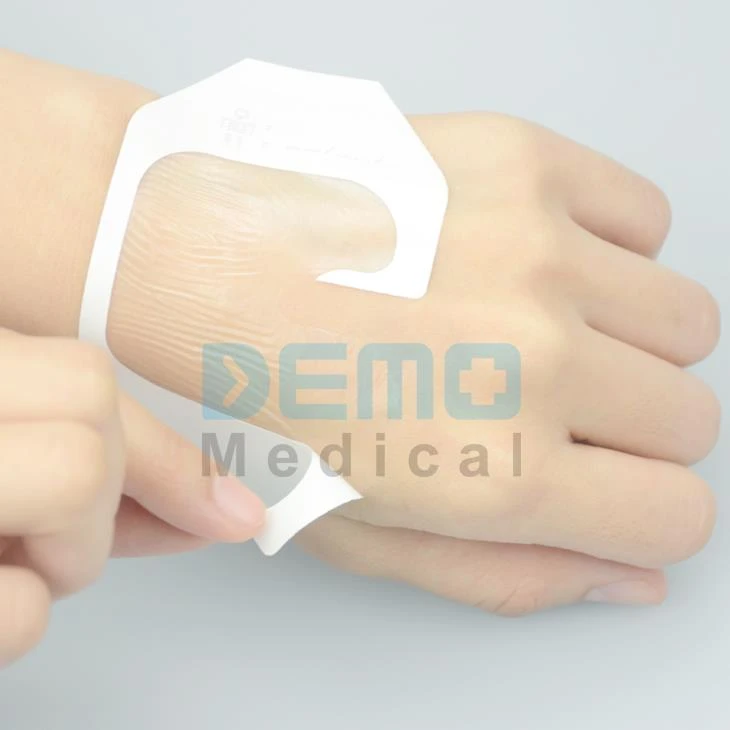 Curativo IV para feridas médicas de uso médico na China